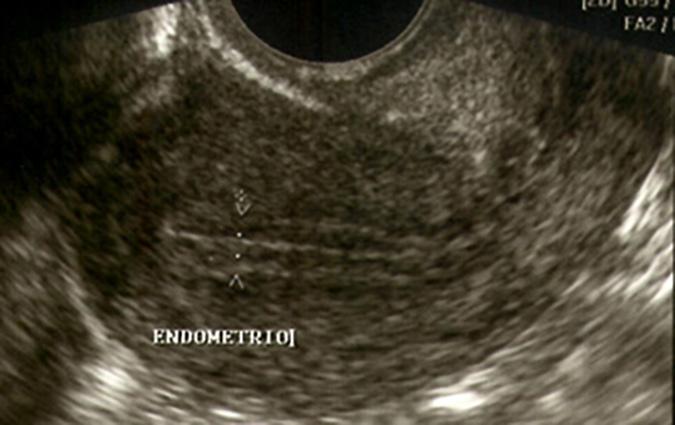 Figure 5