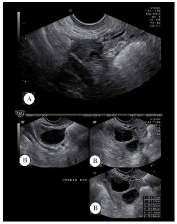 Figure3